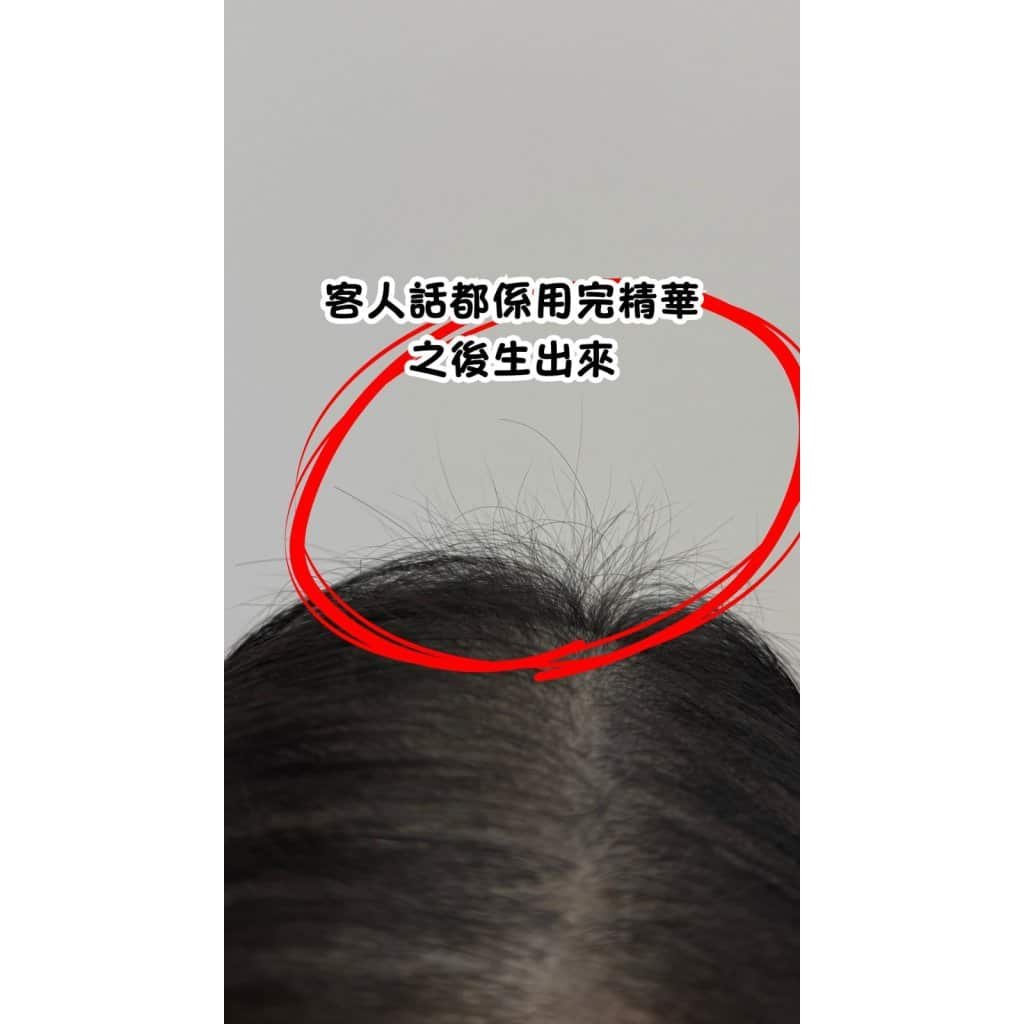 客人新髮生長