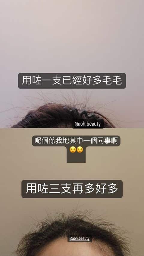 IG Story:用咗一支已經好多毛毛 vs 用咗三支再多好多